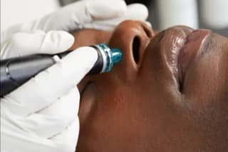 Hydrafacial